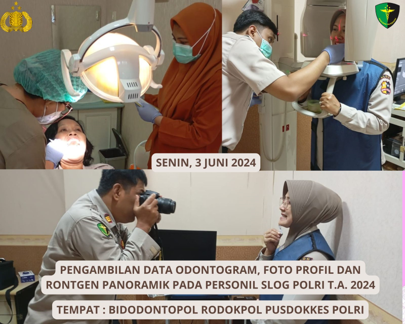 Pengambilan Data Odontogram Personel Slog Polri TA 2024