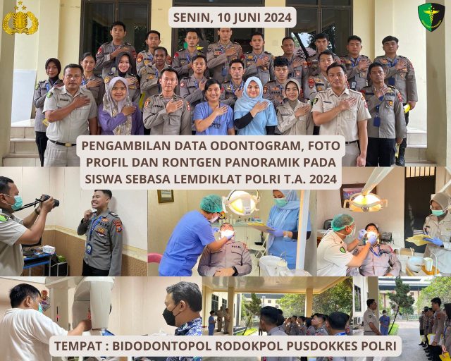 Pengambilan Data Odontogram Personel Siswa Sebasa Lemdiklat Polri TA 2024