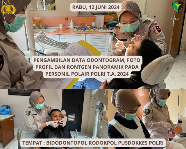 Pengambilan Data Odontogram Personel Polairud TA 2024