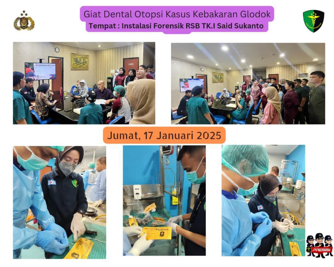 KEGIATAN DENTAL OTOPSI KASUS KEBAKARAN DI GLODOK PLAZA